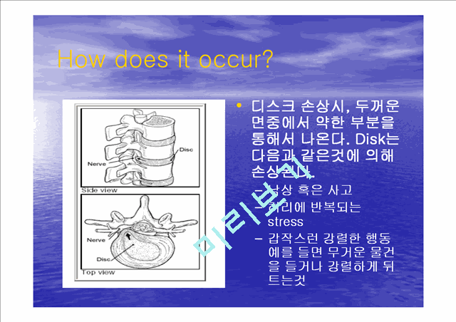 backpain   (4 )